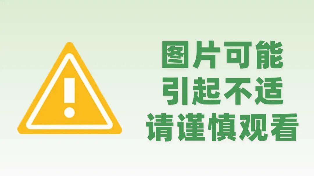 图片可能 引起不适.jpg